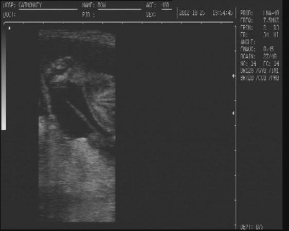 Image 2 of CanineUltrasound scanning in your own home
