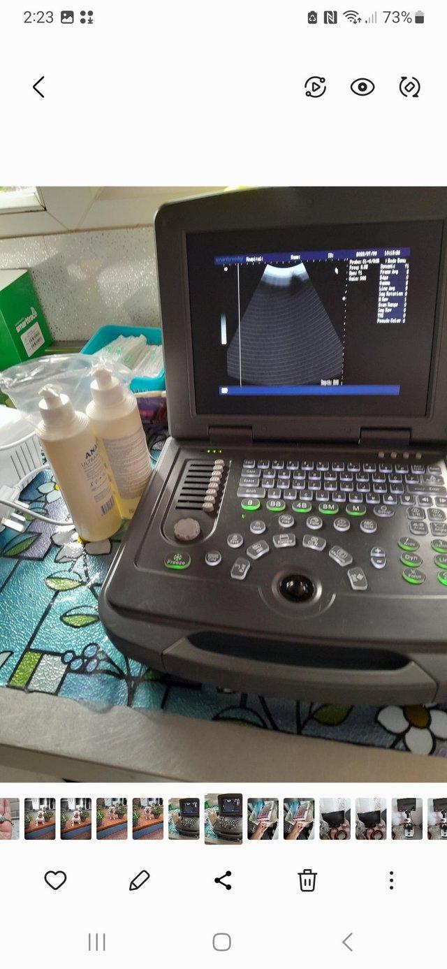 Preview of the first image of HD Notebook ultrasound Scanner.