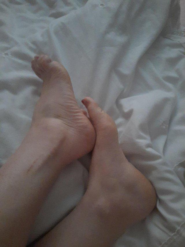 Preview of the first image of 5x set of foot pictures.