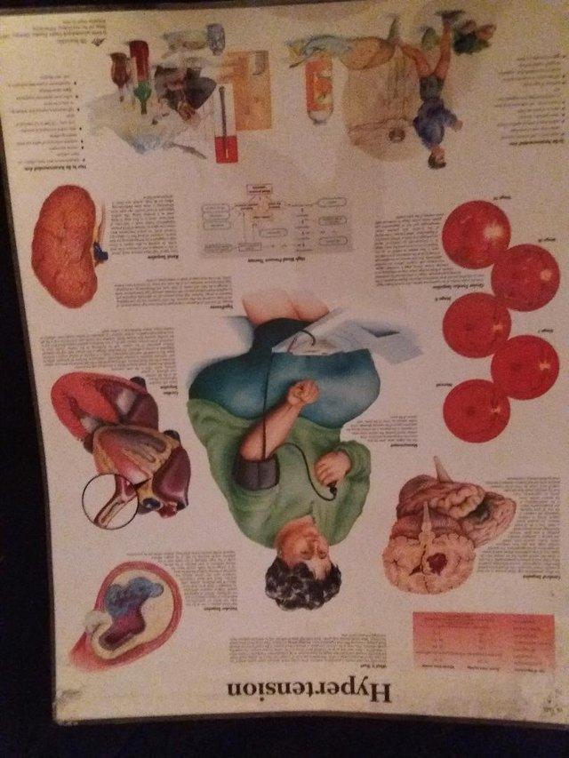 Preview of the first image of 2 COLLECTABLE WIPEABLE MEDICAL POSTERS.