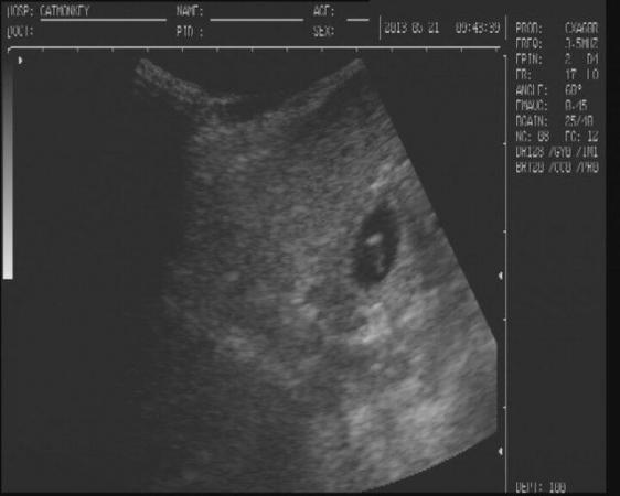 Image 9 of canine ultrasound scanning in your own home