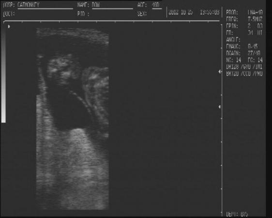 Image 11 of canine ultrasound scanning in your own home
