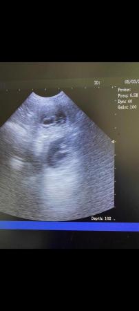 Image 2 of HD Notebook ultrasound Scanner
