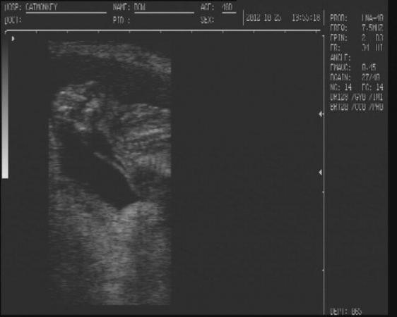 Image 10 of canine ultrasound scanning in your own home